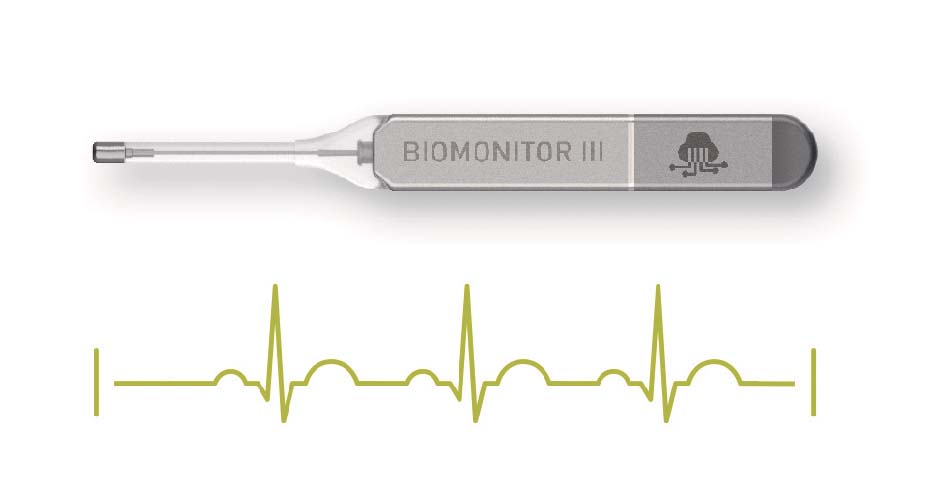 Cardiac Monitoring